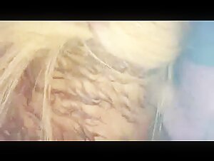 Thumb 10